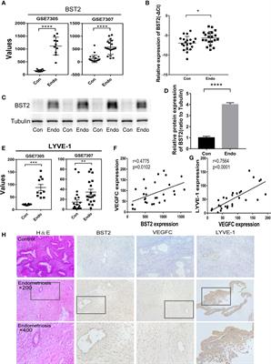 Promotion of BST2 expression by the transcription factor IRF6 affects the progression of endometriosis